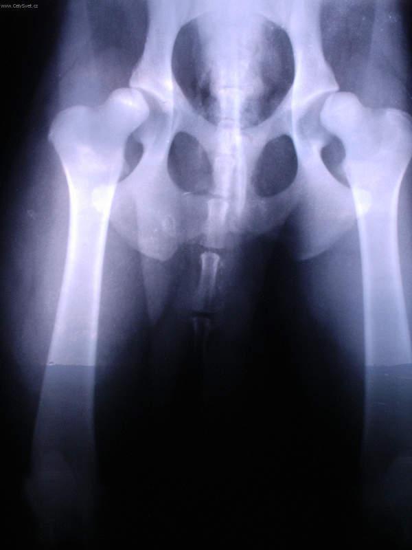 Foto: Ortopedie - DKK