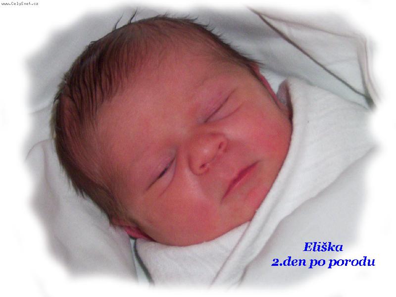 Foto: Uzl��ek �t�st�