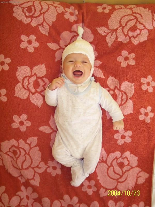 Foto: �iv� "teletab�sek"-Syn po operaci hlavi�ky